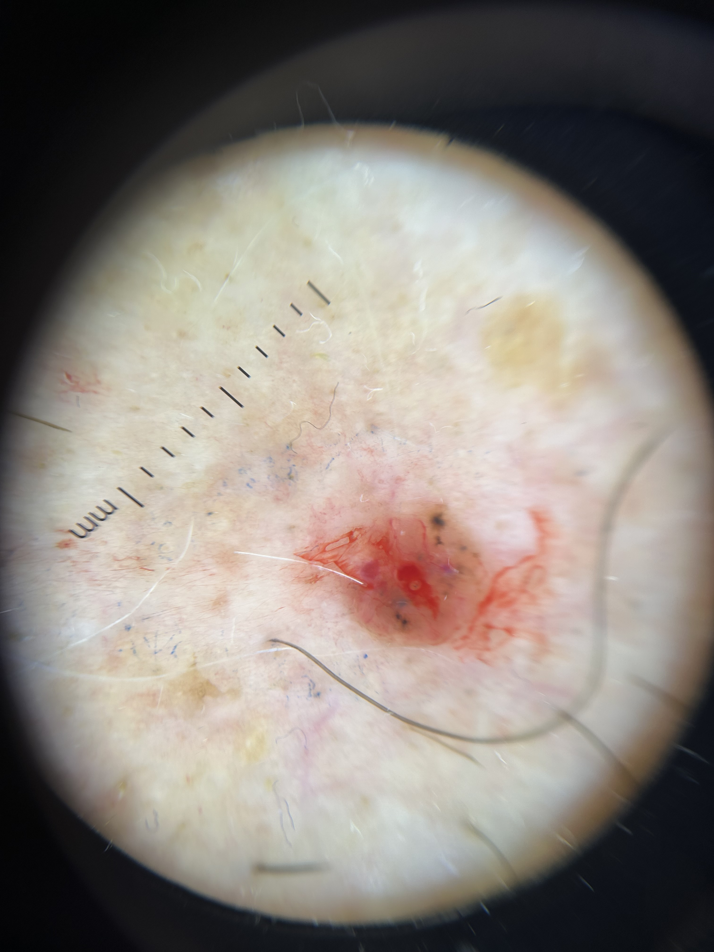 Dermatología estética