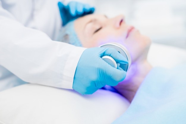 fotorrejuvenecimiento facial