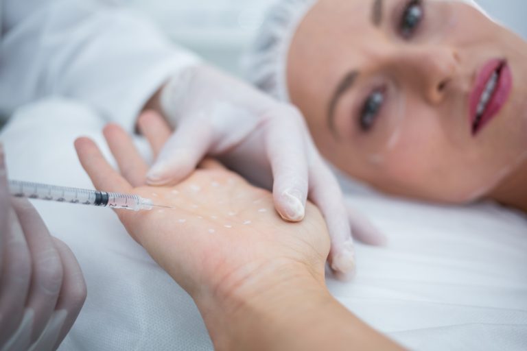 Tratamiento con toxina botulínica para la hiperhidrosis.